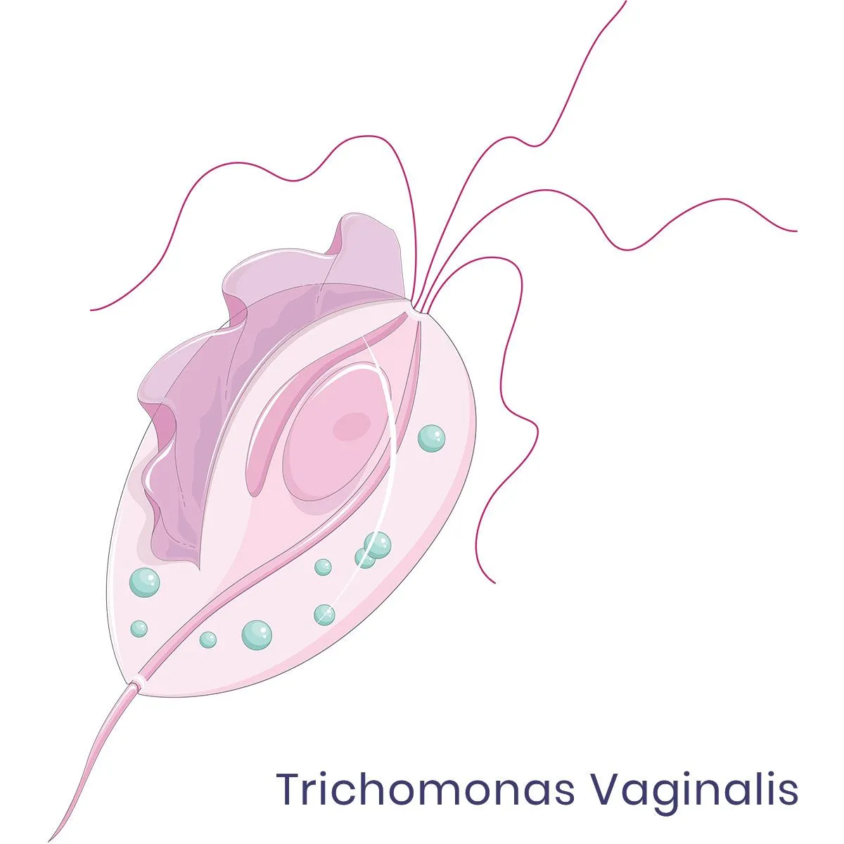 Trichomoniasis Treatment - Trichomoniasis Vaginalis